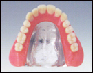 写真：コバルトクロム床義歯